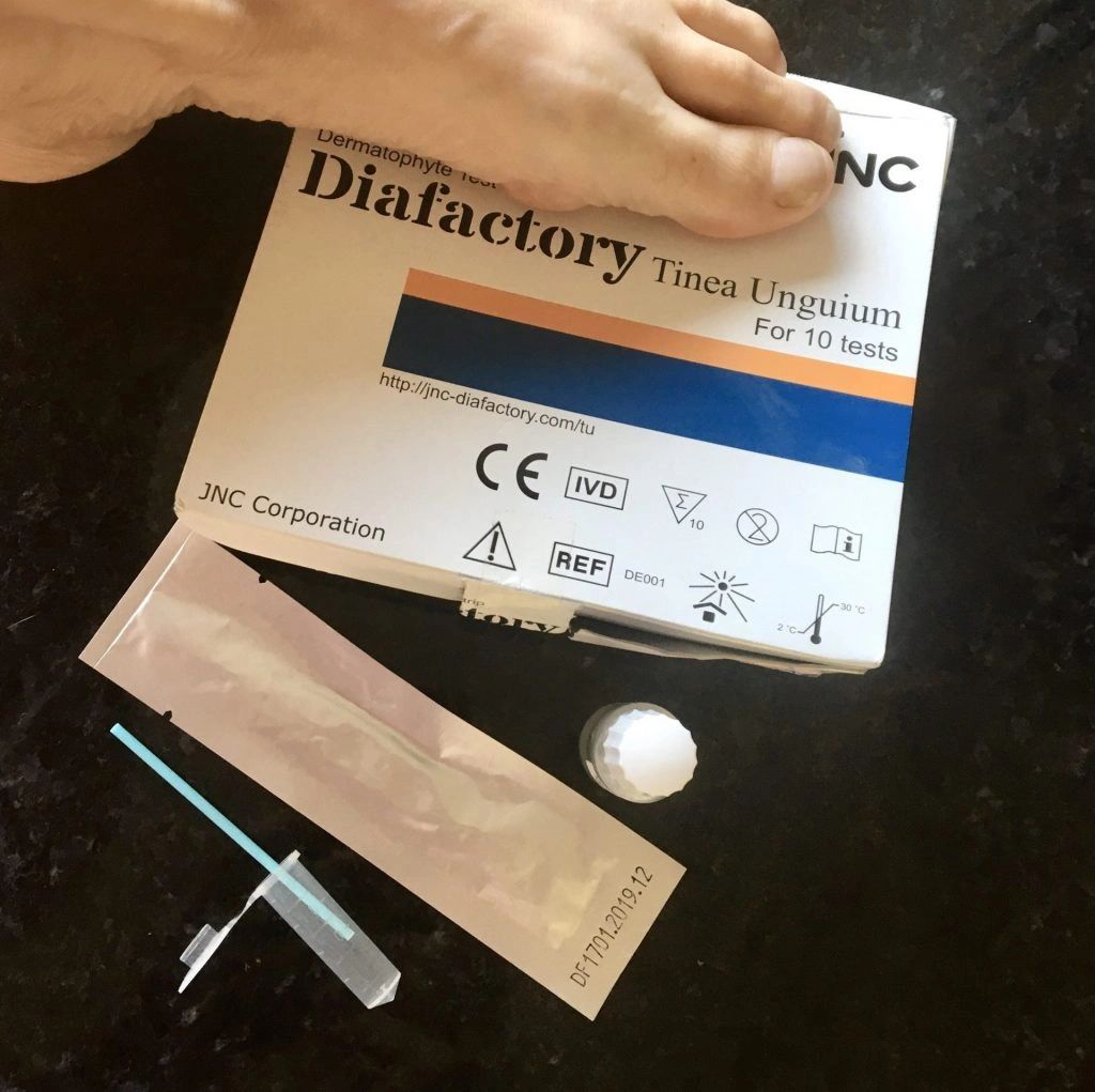 New Five Minute Fungal Nail Test